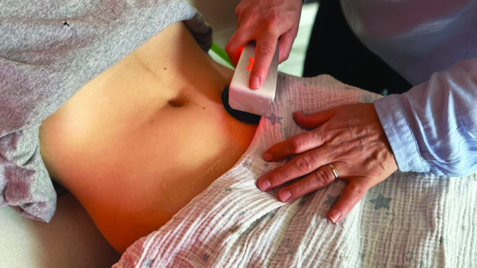 Técarthérapie : une pratique qui gagne du terrain chez les sages-femmes